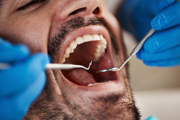 Best Emergency Broken Tooth Repair in Lake Barrington, IL